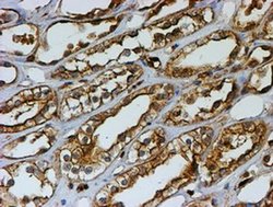 Invitrogen PSMB9 Monoclonal Antibody (OTI1C4) 100 &mu;L; Unconjugated:Antibodies,