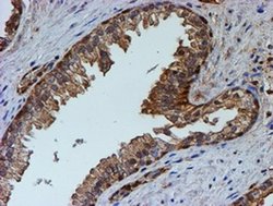 Invitrogen PSMB9 Monoclonal Antibody (OTI1C4) 100 &mu;L; Unconjugated:Antibodies,