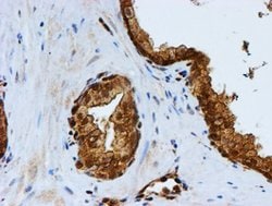 Invitrogen PSMB9 Monoclonal Antibody (OTI1C4) 100 &mu;L; Unconjugated:Antibodies,
