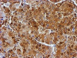 Invitrogen PSMB9 Monoclonal Antibody (OTI1C4) 100 &mu;L; Unconjugated:Antibodies,