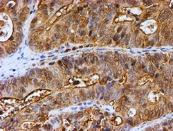 Invitrogen PSMB9 Monoclonal Antibody (OTI1C4) 100 &mu;L; Unconjugated:Antibodies,