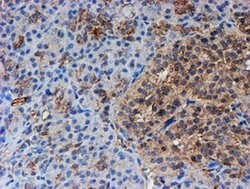 Invitrogen PSMB9 Monoclonal Antibody (OTI1C4) 100 &mu;L; Unconjugated:Antibodies,