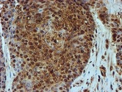 Invitrogen PSMB9 Monoclonal Antibody (OTI1C4) 100 &mu;L; Unconjugated:Antibodies,