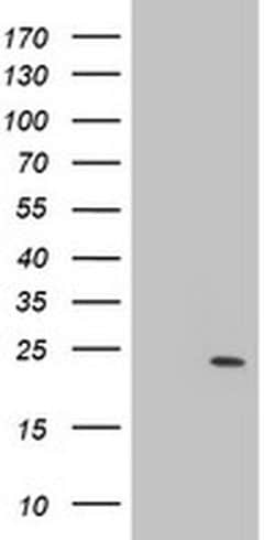 Invitrogen PSMB9 Monoclonal Antibody (OTI1C4) 100 &mu;L; Unconjugated:Antibodies,