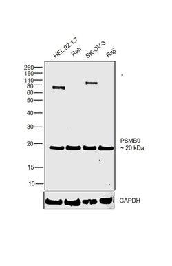 Invitrogen&trade;&nbsp;PSMB9 Monoclonal Antibody (OTI1D1)