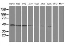 Invitrogen SERPINA5 Monoclonal Antibody (OTI1A12) 100 &mu;L; Unconjugated:Antibodies,