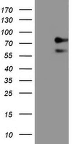 Invitrogen ALOX15 Monoclonal Antibody (OTI7H6) 100 &mu;L; Unconjugated:Antibodies,