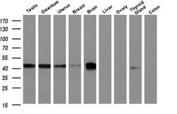 Invitrogen BCAT1 Monoclonal Antibody (OTI3F5) 100 &mu;L; Unconjugated:Antibodies,