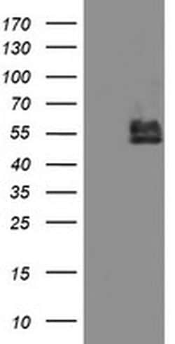 Invitrogen BCAT1 Monoclonal Antibody (OTI3F5) 100 &mu;L; Unconjugated:Antibodies,