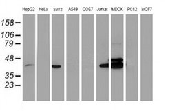 Invitrogen BCAT1 Monoclonal Antibody (OTI3F5) 100 &mu;L; Unconjugated:Antibodies,