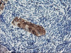 Invitrogen DPP8 Monoclonal Antibody (OTI1D2) 100 &mu;L; Unconjugated:Antibodies,