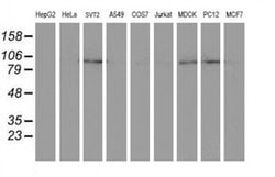 Invitrogen DPP8 Monoclonal Antibody (OTI1D2) 100 &mu;L; Unconjugated:Antibodies,