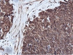 Invitrogen&trade;&nbsp;PSMB7 Monoclonal Antibody (OTI1E1)