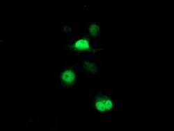 Invitrogen PSMB7 Monoclonal Antibody (OTI4G9) 100 &mu;L; Unconjugated:Antibodies,