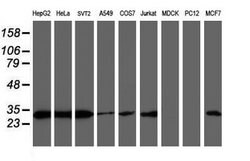 Invitrogen PSMB7 Monoclonal Antibody (OTI4G9) 100 &mu;L; Unconjugated:Antibodies,
