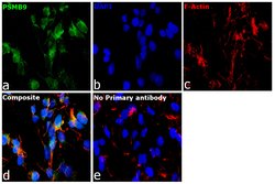 Invitrogen™ PSMB9 Monoclonal Antibody (OTI1F10)