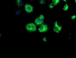 Invitrogen SPG7 Monoclonal Antibody (OTI1C12) 100 &mu;L; Unconjugated:Antibodies,