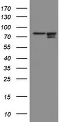 Invitrogen SPG7 Monoclonal Antibody (OTI1C12) 100 &mu;L; Unconjugated:Antibodies,