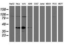 Invitrogen SPG7 Monoclonal Antibody (OTI1C12) 100 &mu;L; Unconjugated:Antibodies,
