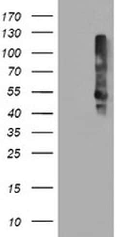 Invitrogen TMEFF2 Monoclonal Antibody (OTI1F9) 100 &mu;L; Unconjugated:Antibodies,