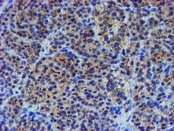 Invitrogen LIM1 Monoclonal Antibody (OTI2D5) 100 &mu;L; Unconjugated:Antibodies,