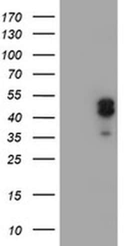 Invitrogen LIM1 Monoclonal Antibody (OTI2D5) 100 &mu;L; Unconjugated:Antibodies,