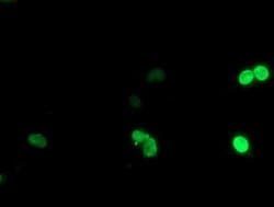 Invitrogen LIM1 Monoclonal Antibody (OTI2D3) 100 &mu;L; Unconjugated:Antibodies,