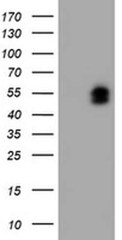 Invitrogen LIM1 Monoclonal Antibody (OTI2D3) 100 &mu;L; Unconjugated:Antibodies,