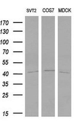 Invitrogen LIM1 Monoclonal Antibody (OTI2D3) 100 &mu;L; Unconjugated:Antibodies,