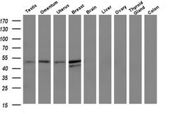 Invitrogen TMEFF2 Monoclonal Antibody (OTI1E1) 100 &mu;L; Unconjugated:Antibodies,