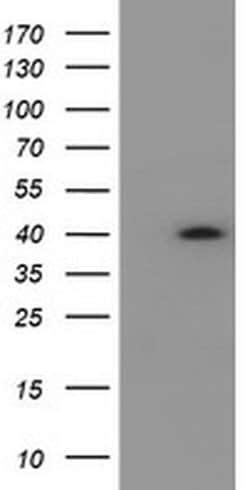 Invitrogen HSD17B2 Monoclonal Antibody (OTI4F10) 100 &mu;L; Unconjugated:Antibodies,