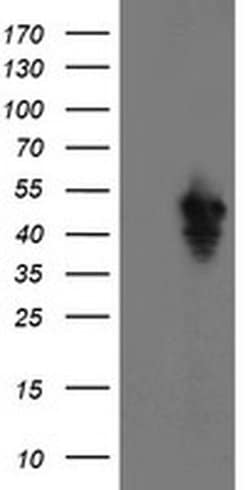 Invitrogen SERPINE2 Monoclonal Antibody (OTI4E4) 100 &mu;L; Unconjugated:Antibodies,