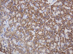 Invitrogen Ribophorin II Monoclonal Antibody (OTI1G9) 100 &mu;L; Unconjugated:Antibodies,