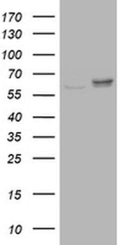 Invitrogen Ribophorin II Monoclonal Antibody (OTI1G9) 100 &mu;L; Unconjugated:Antibodies,