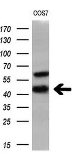 Invitrogen HSD17B2 Monoclonal Antibody (OTI3E9) 100 &mu;L; Unconjugated:Antibodies,