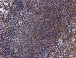Invitrogen ATRIP Monoclonal Antibody (OTI5E7) 100 &mu;L; Unconjugated:Antibodies,