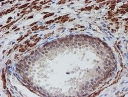 Invitrogen ATRIP Monoclonal Antibody (OTI5E7) 100 &mu;L; Unconjugated:Antibodies,
