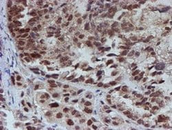 Invitrogen ATRIP Monoclonal Antibody (OTI5E7) 100 &mu;L; Unconjugated:Antibodies,