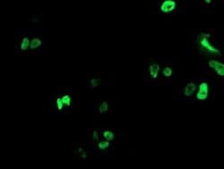 Invitrogen RUNX1T1 Monoclonal Antibody (OTI1H1) 100 &mu;L; Unconjugated:Antibodies,