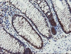 Invitrogen PPAT Monoclonal Antibody (OTI1B11) 100 &mu;L; Unconjugated:Antibodies,