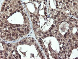 Invitrogen PPAT Monoclonal Antibody (OTI1B11) 100 &mu;L; Unconjugated:Antibodies,