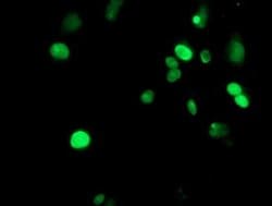 Invitrogen METT10D Monoclonal Antibody (OTI3B5) 100 &mu;L; Unconjugated:Antibodies,