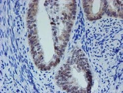Invitrogen METT10D Monoclonal Antibody (OTI3B5) 100 &mu;L; Unconjugated:Antibodies,