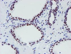 Invitrogen METT10D Monoclonal Antibody (OTI3B5) 100 &mu;L; Unconjugated:Antibodies,