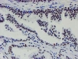 Invitrogen METT10D Monoclonal Antibody (OTI3B5) 100 &mu;L; Unconjugated:Antibodies,