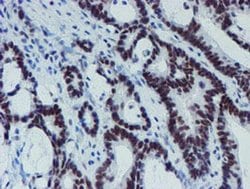 Invitrogen METT10D Monoclonal Antibody (OTI3B5) 100 &mu;L; Unconjugated:Antibodies,