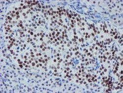 Invitrogen METT10D Monoclonal Antibody (OTI3B5) 100 &mu;L; Unconjugated:Antibodies,