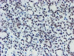 Invitrogen METT10D Monoclonal Antibody (OTI3B5) 100 &mu;L; Unconjugated:Antibodies,