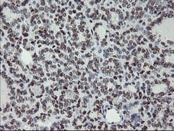 Invitrogen MLF1 Monoclonal Antibody (OTI3A3) 100 &mu;L; Unconjugated:Antibodies,