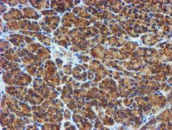 Invitrogen PPAT Monoclonal Antibody (OTI1B8) 100 &mu;L | Buy Online | Invitrogen&trade; | Fisher Scientific